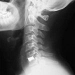 Cuello