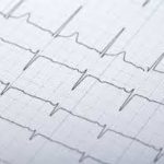 ekg-web